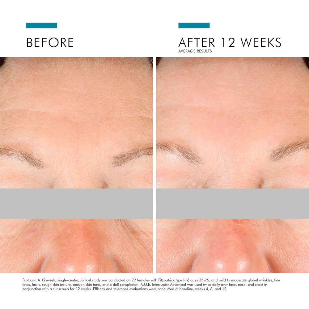 SkinCeuticals A.G.E. Interrupter Advanced