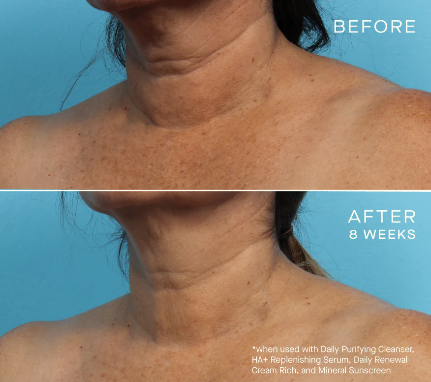 Ourself Advanced Regenerative Serum