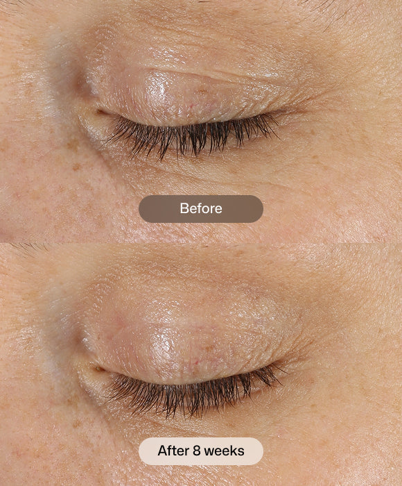 Revision Skincare D·E·J Eye Cream