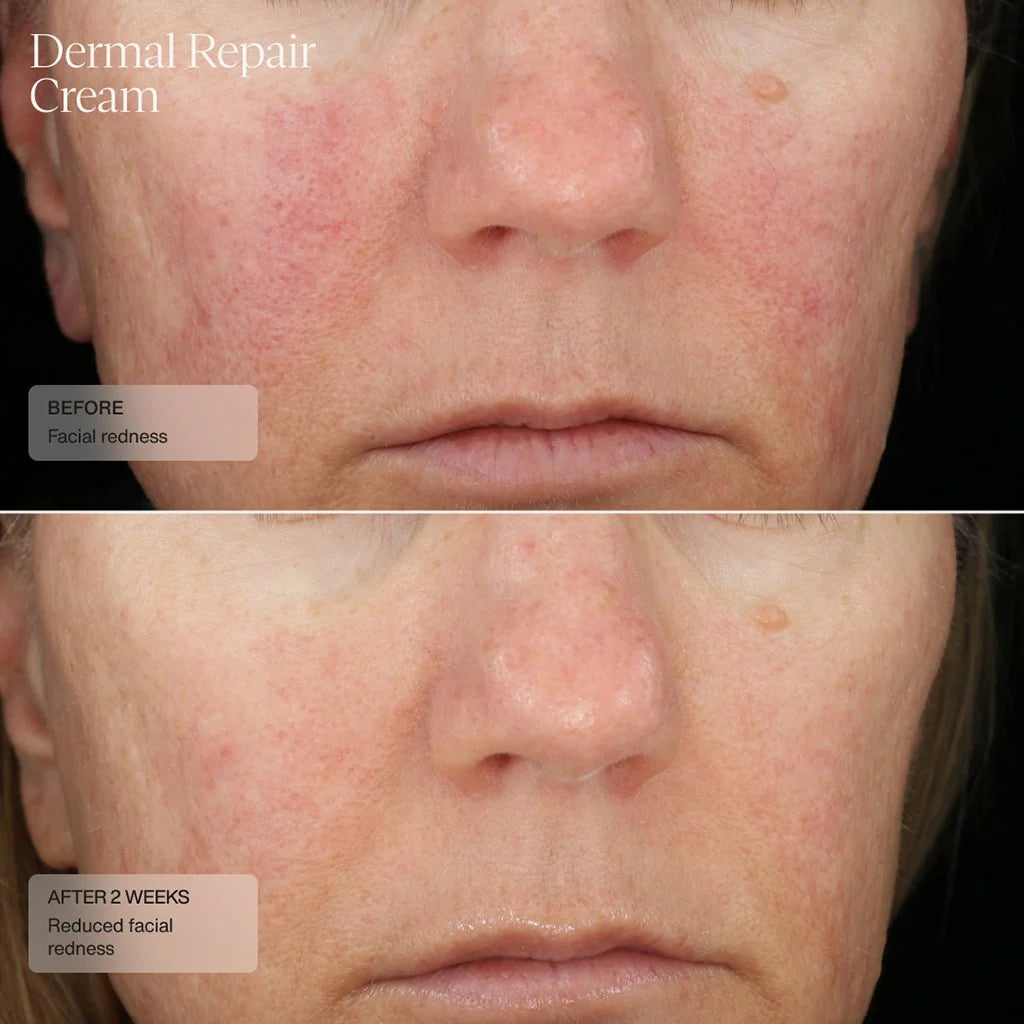 Sente Dermal Repair Cream