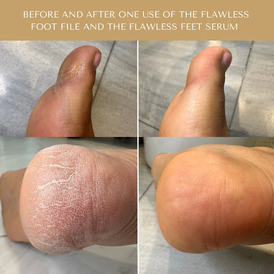 Serum Doctor Flawless Feet System
