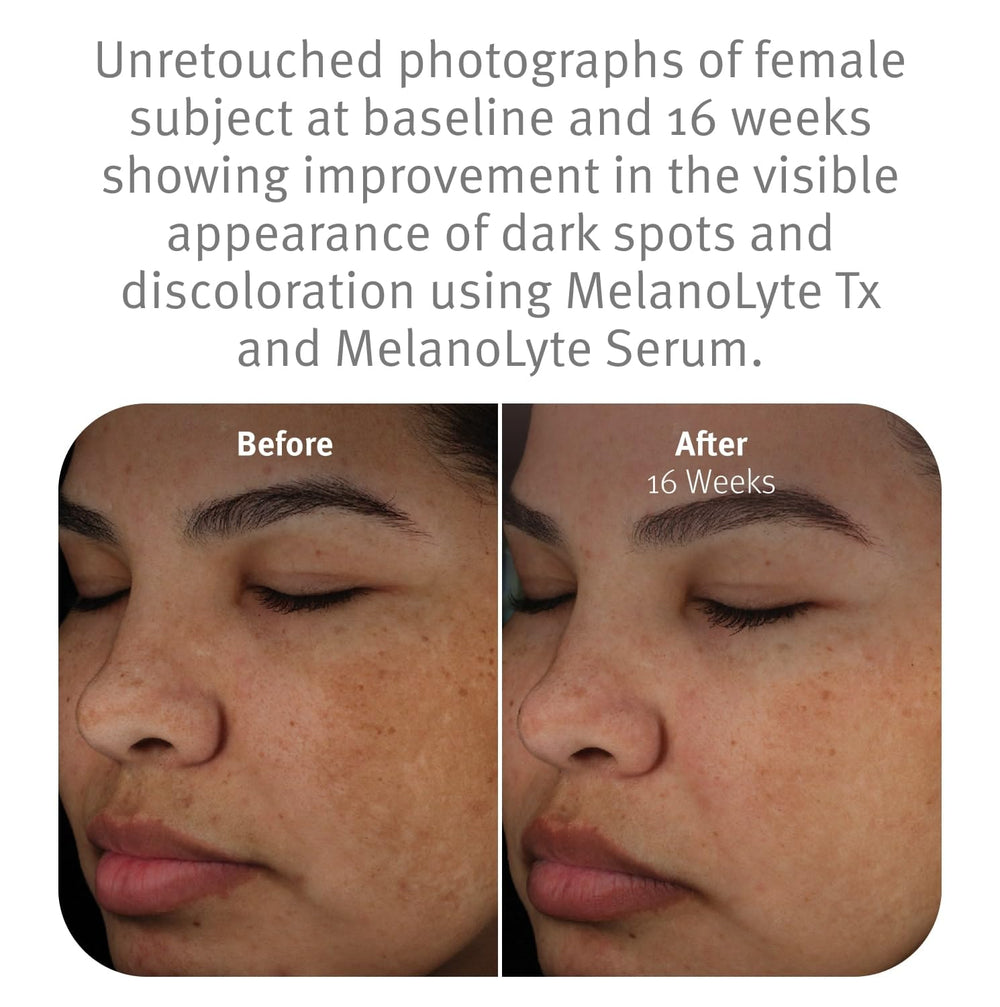 Epionce Melanolyte Tx Brightening Lotion