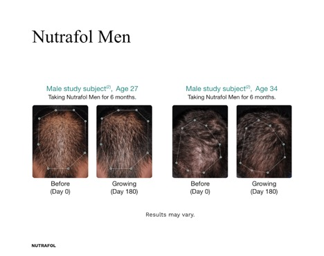 Nutrafol Men