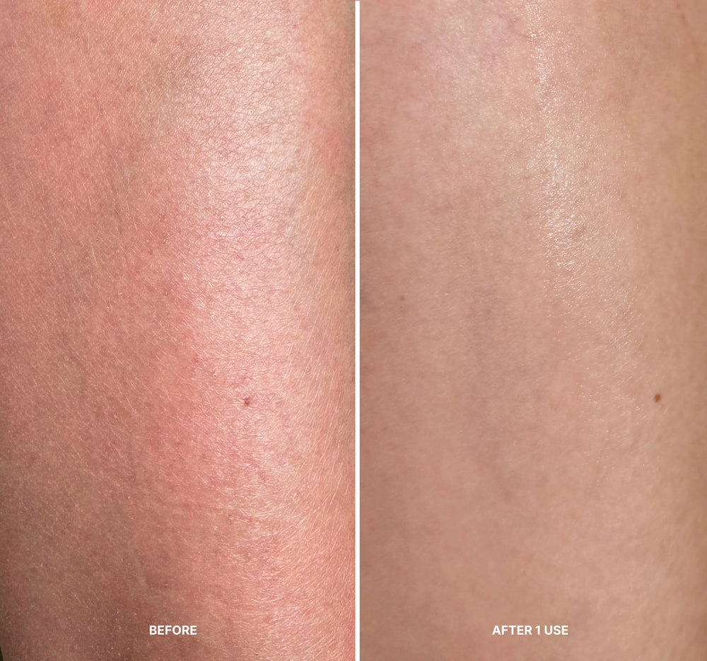LILIS Instant Peel