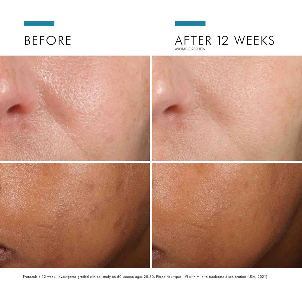 SkinCeuticals Phloretin CF with Ferulic Acid