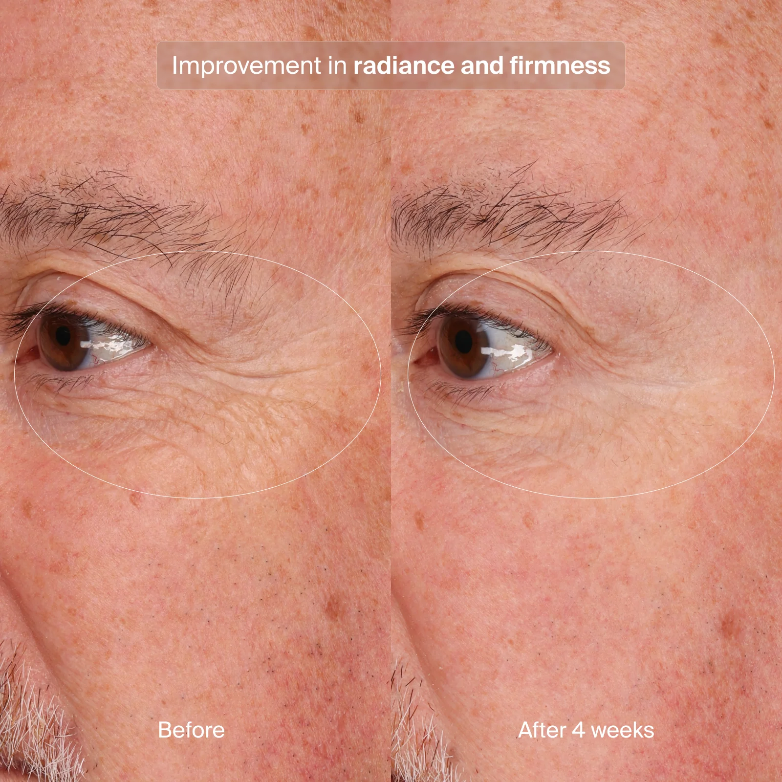 Pavise Precision Eye Lift