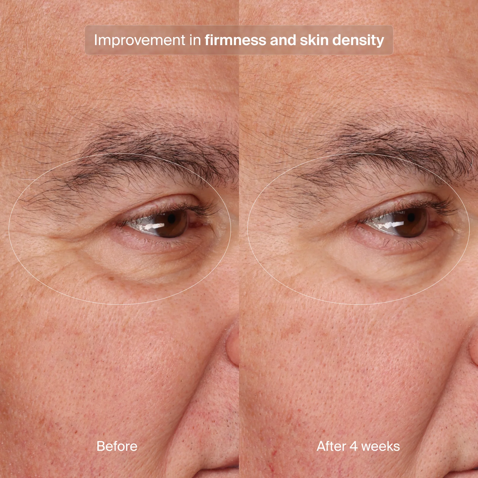 Pavise Precision Eye Lift