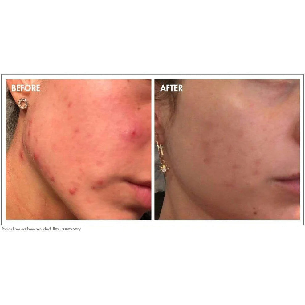 Glowbiotics Probiotic Clarifying Cleanser