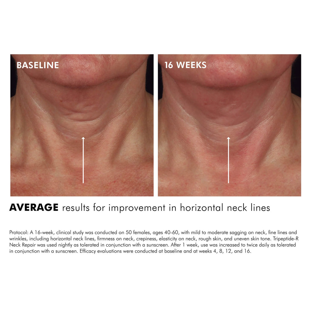 SkinCeuticals Tripeptide-R Neck Repair