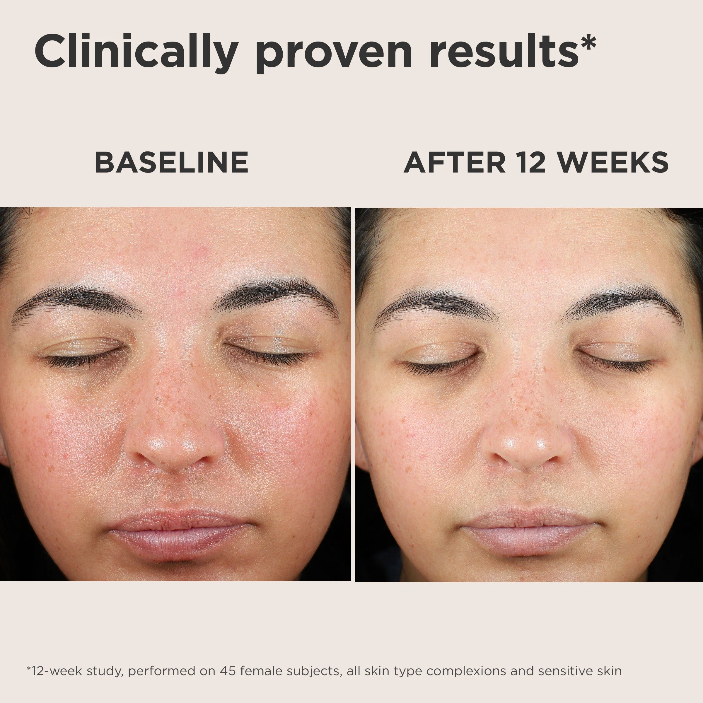 EltaMD UV Skin Recovery Broad Spectrum SPF 50 Face Sunscreen