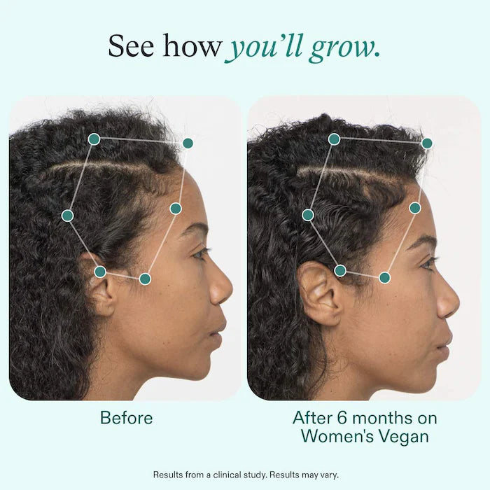 Nutrafol Women's Vegan