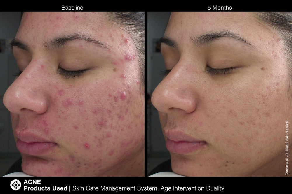 Marini Skin Solutions Duality