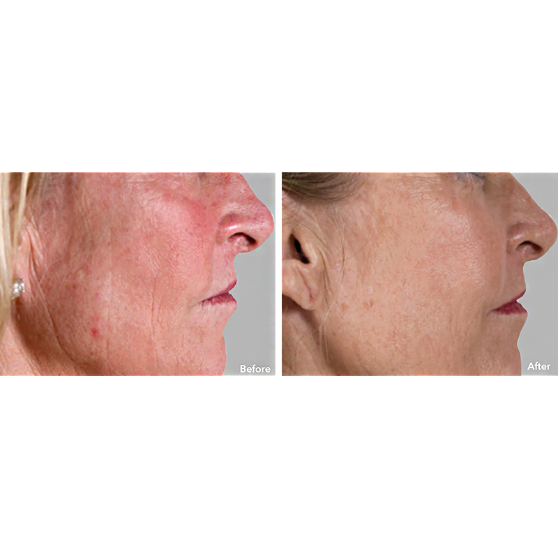 AnteAGE System – skinBEAUTIFUL RX