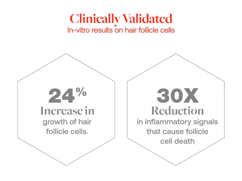 Calecim Advanced Hair System