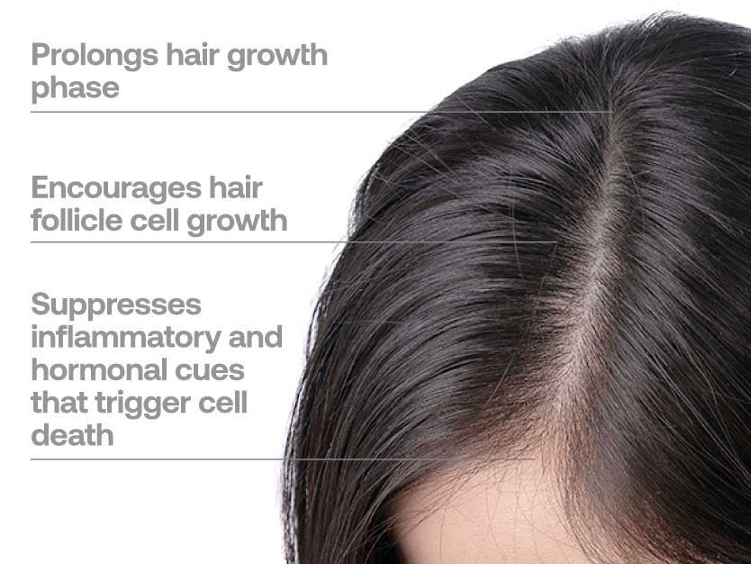 Calecim Advanced Hair System