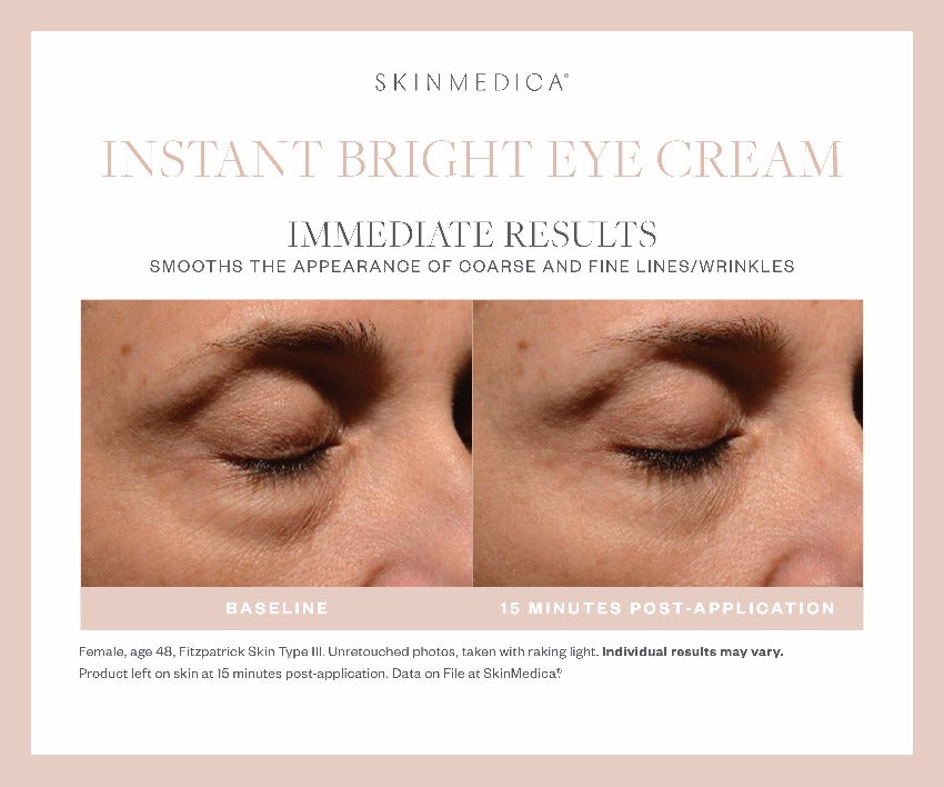 SkinMedica Instant Bright Eye Cream skinBEAUTIFUL RX
