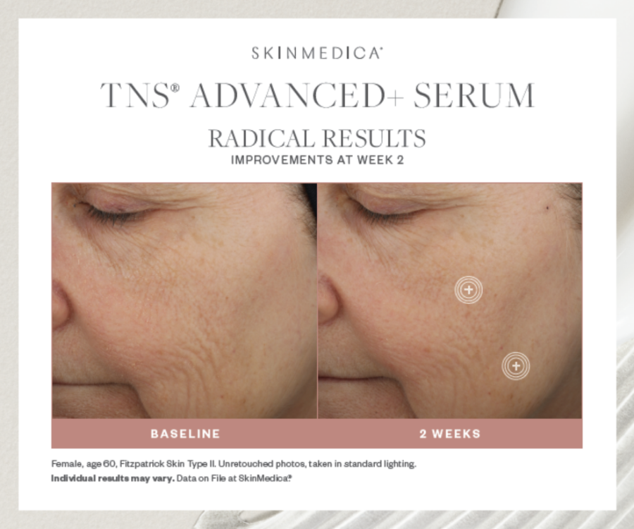 SkinMedica's TNS Advanced+ Serum Authentic Sealed NIB 02/24 Exp hotsell