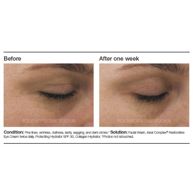 PCA Skin Ideal Complex Revitalizing Eye Gel