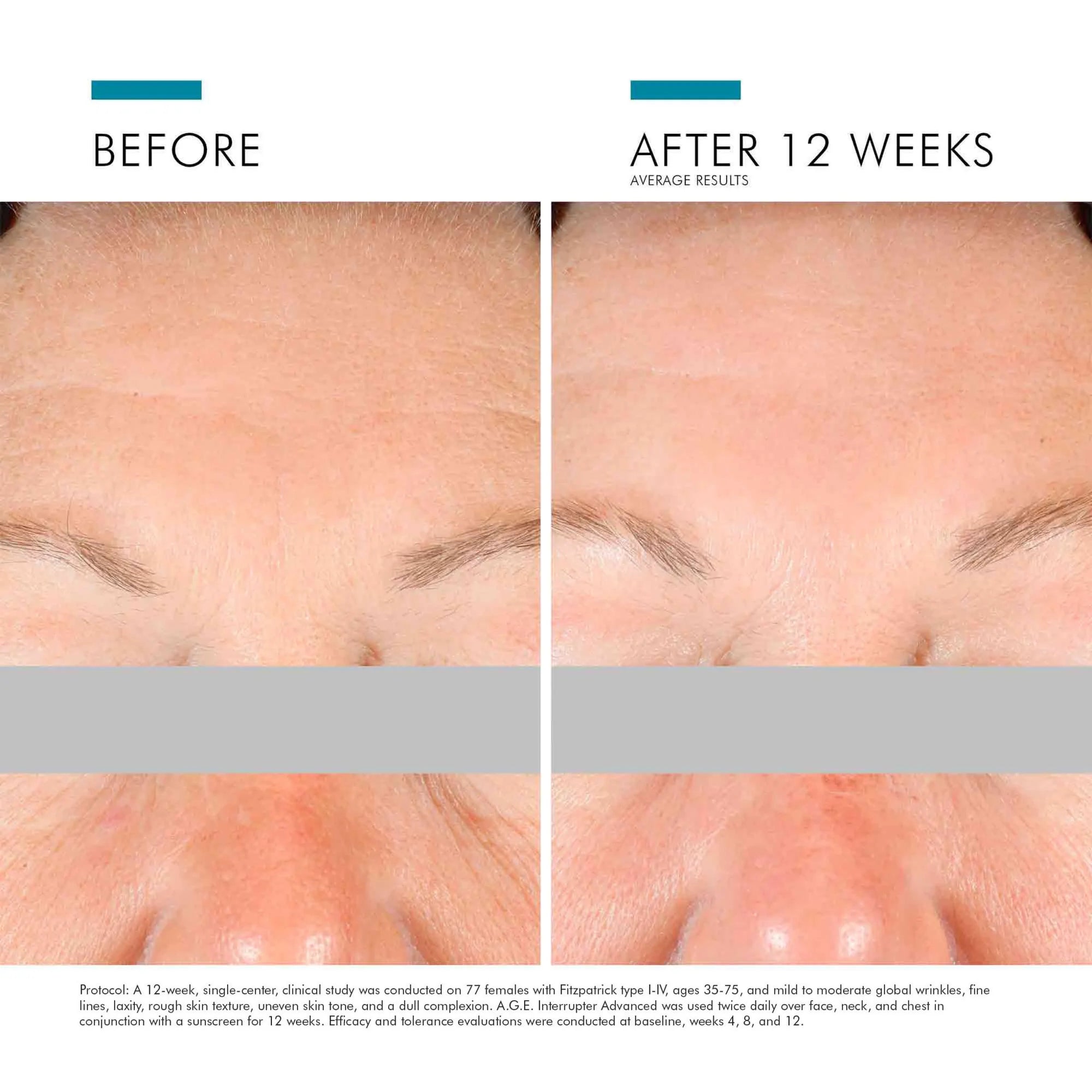 SkinCeuticals A.G.E. Interrupter Advanced