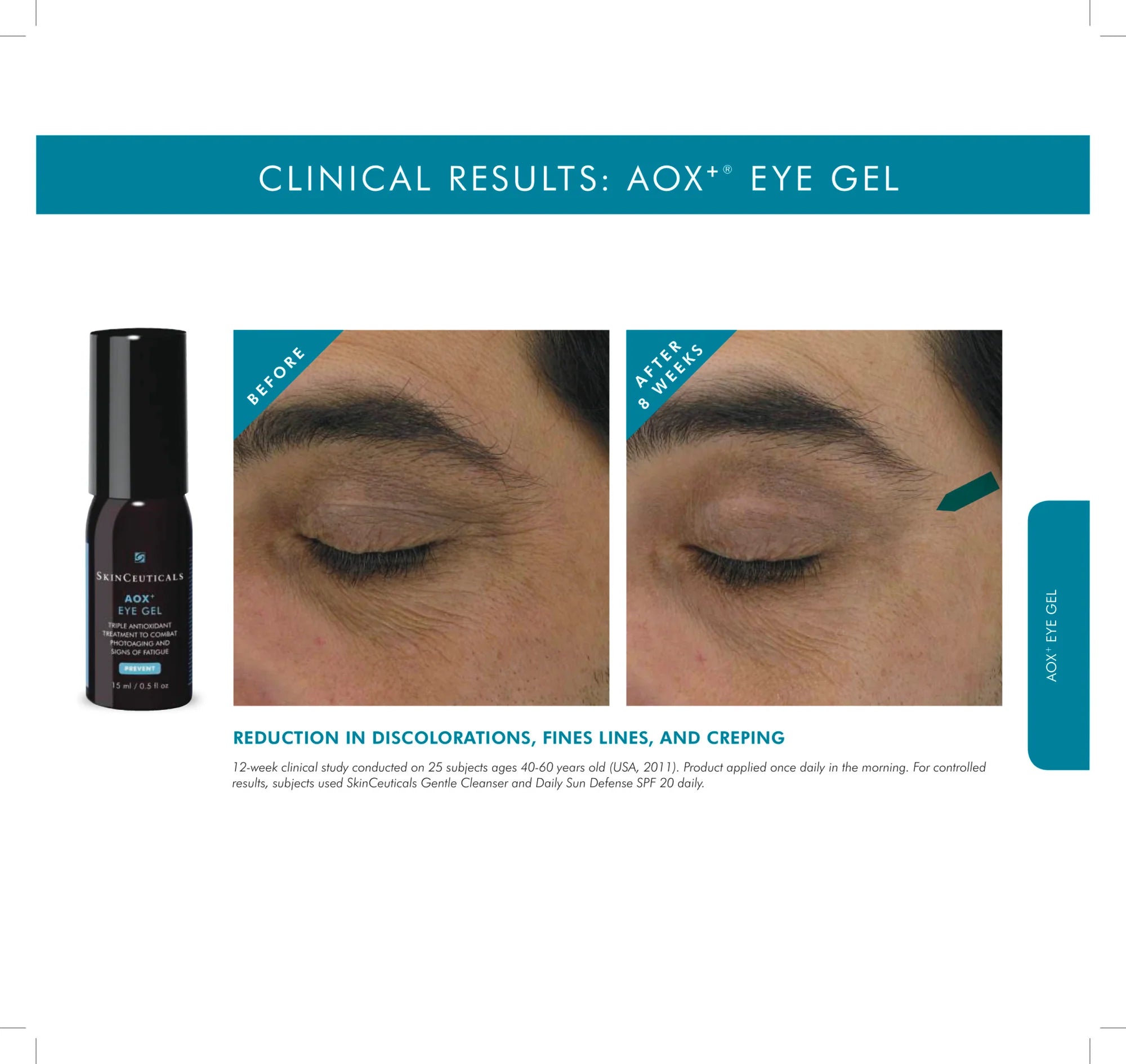 SkinCeuticals online AOX eye gel