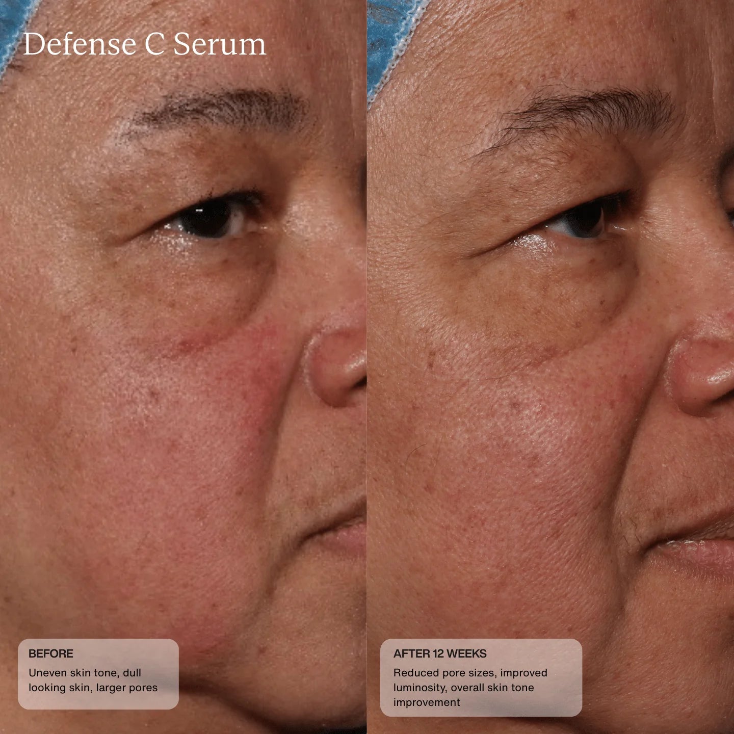 Sente Defense C Serum