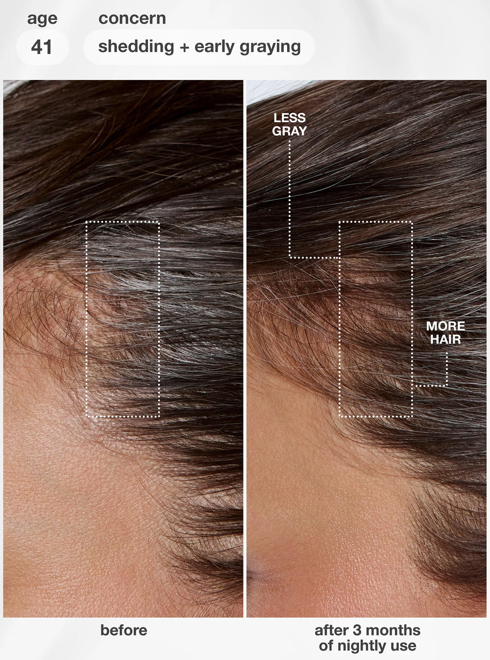 K18 FutureIQ™ Biomimetic Hair Longevity Serum