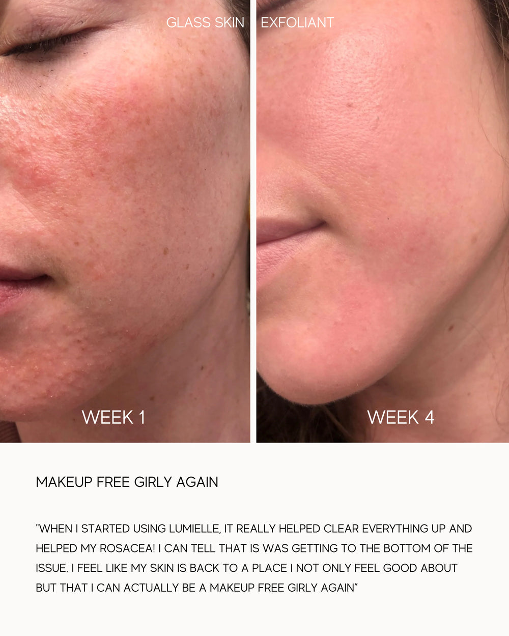 Lumielle Glass Skin Liquid Exfoliant
