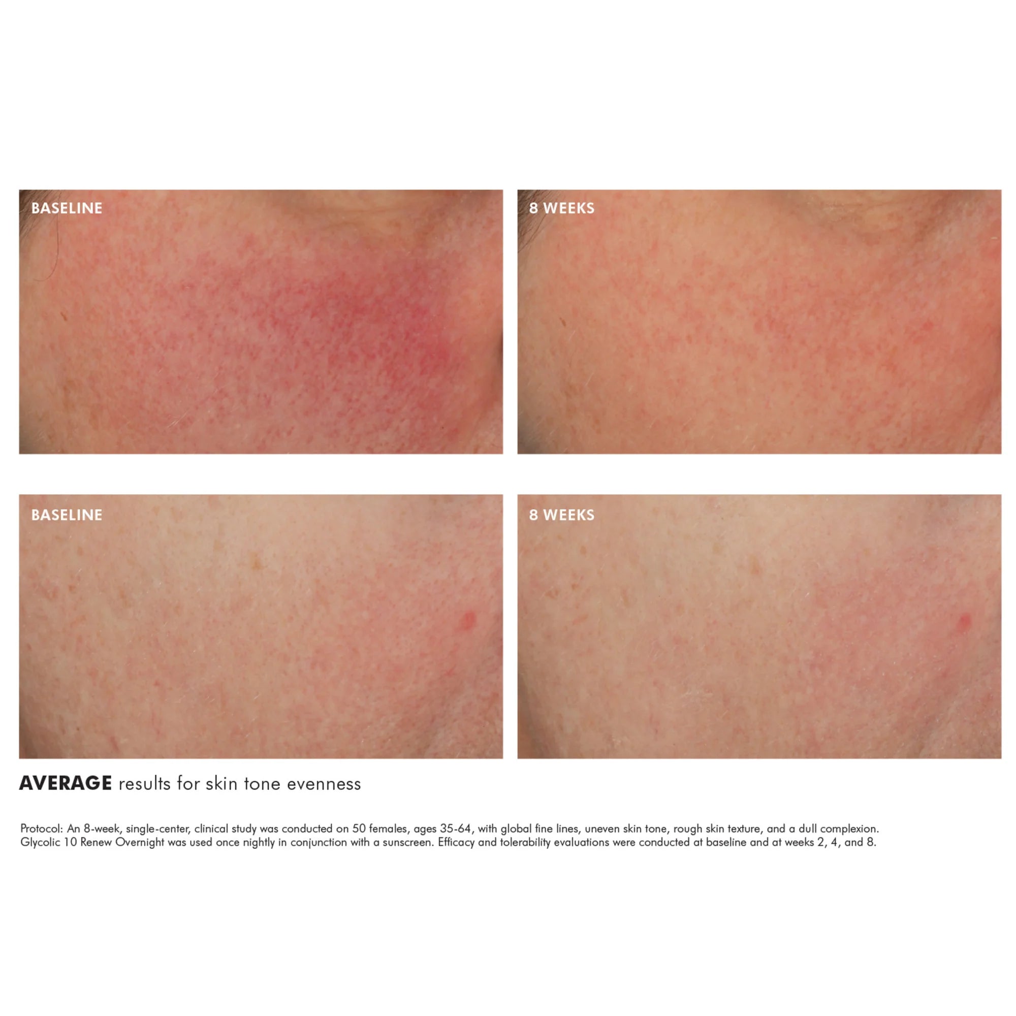 SkinCeuticals Glycolic 10 Renew Overnight