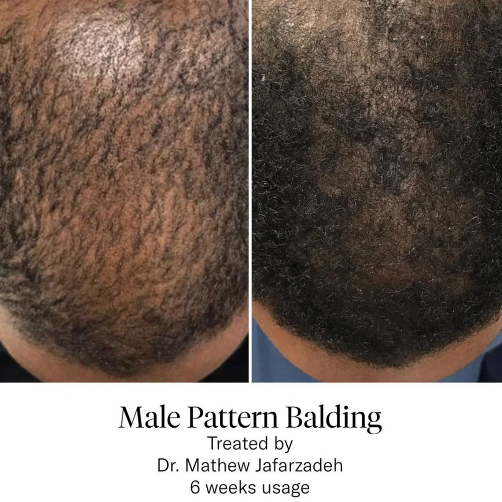 Calecim HAIR Serum