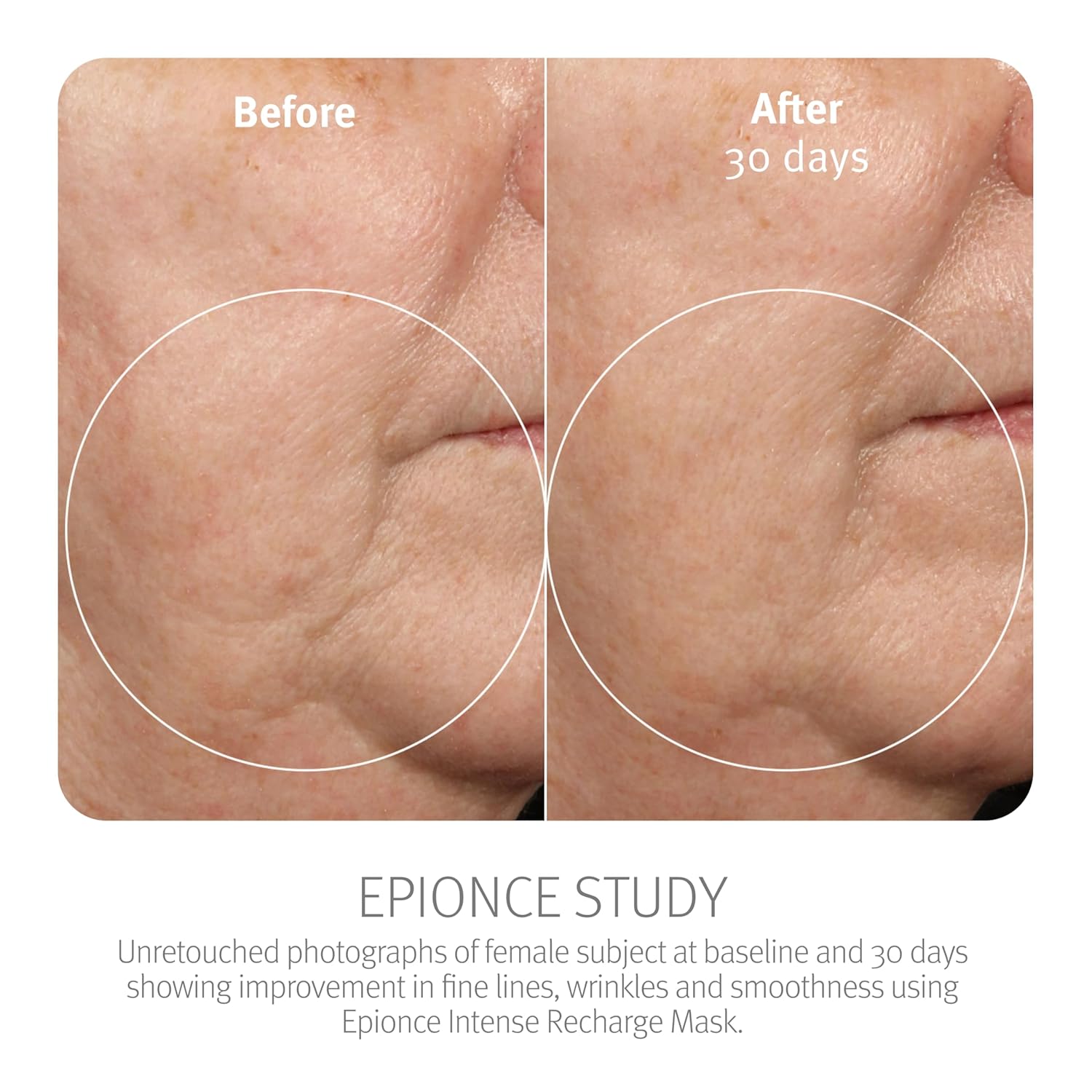 Epionce Intense Recharge Mask
