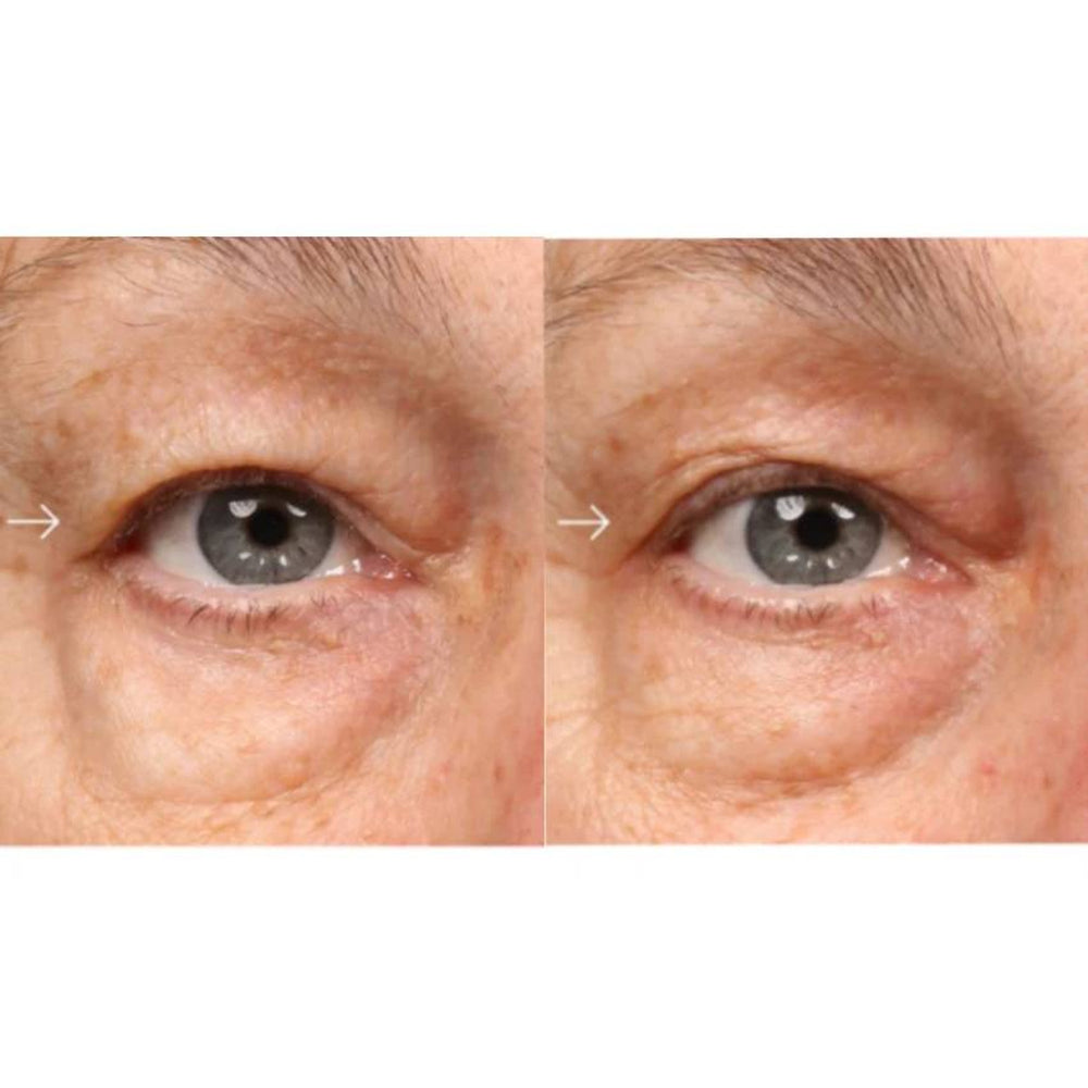 Epionce Luminous Eye Serum