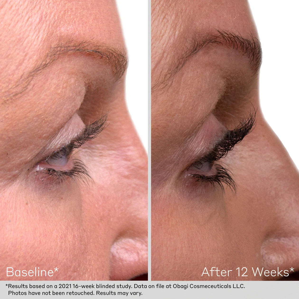 Obagi Nu-Cil Lash & Brow Serum Set