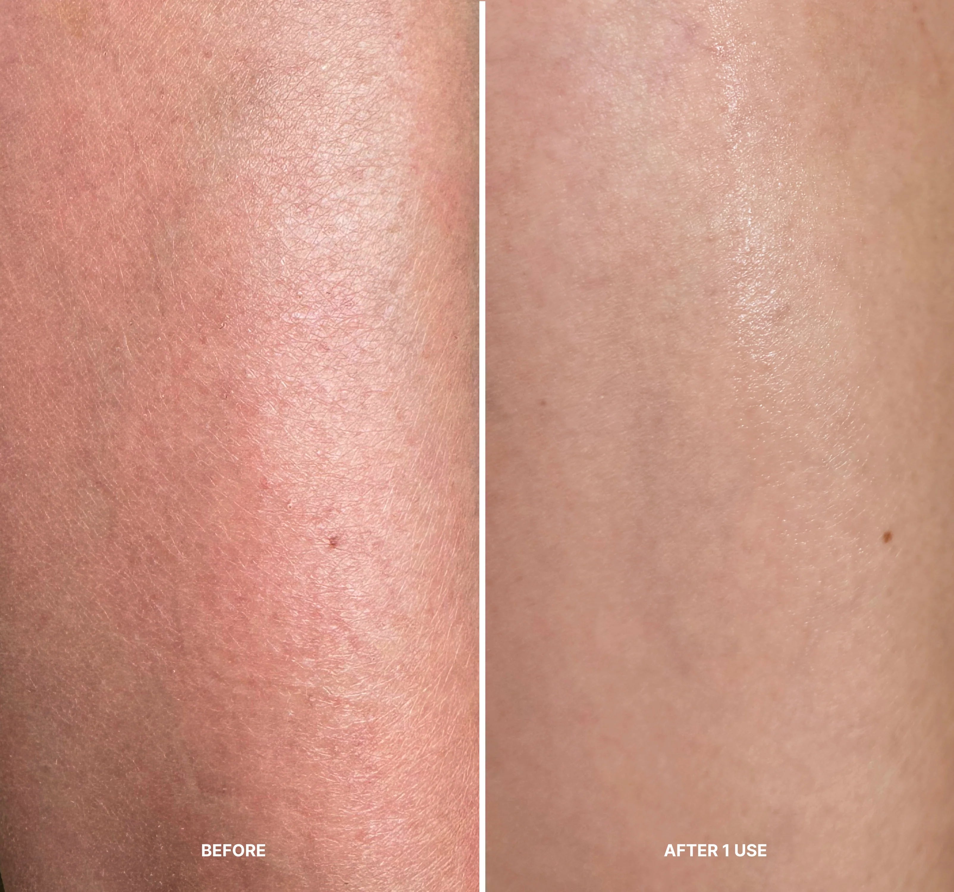 LILIS Instant Peel