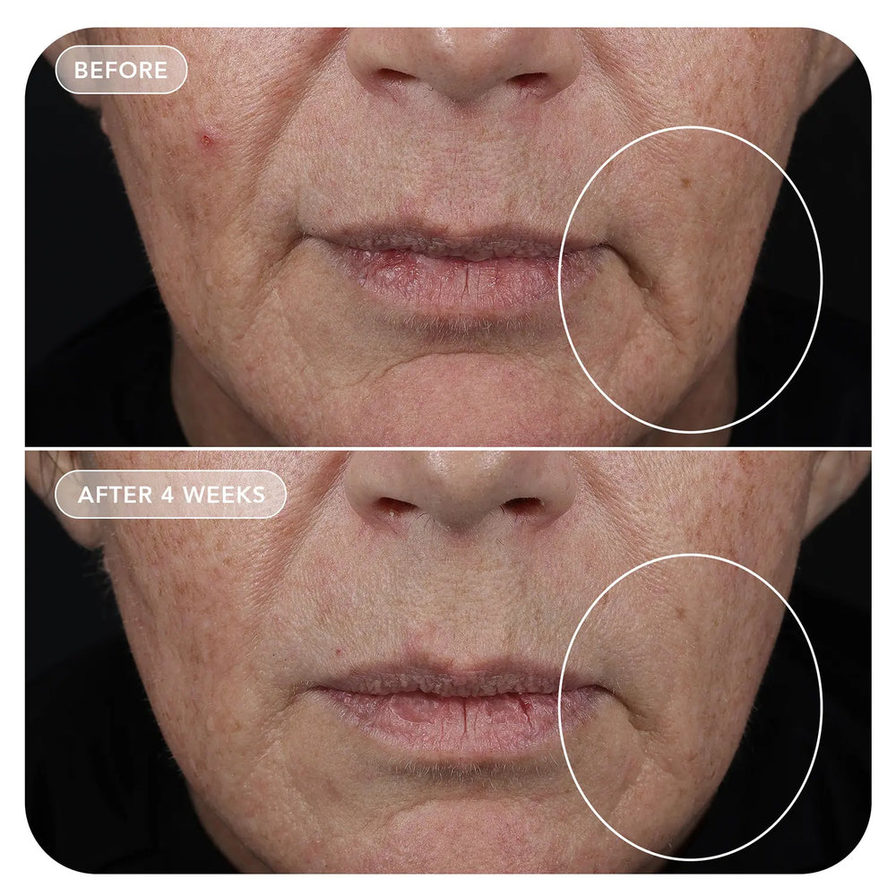 Image Skincare VOL.U.LIFT® GLP-1 4D Skin Rebound Complex