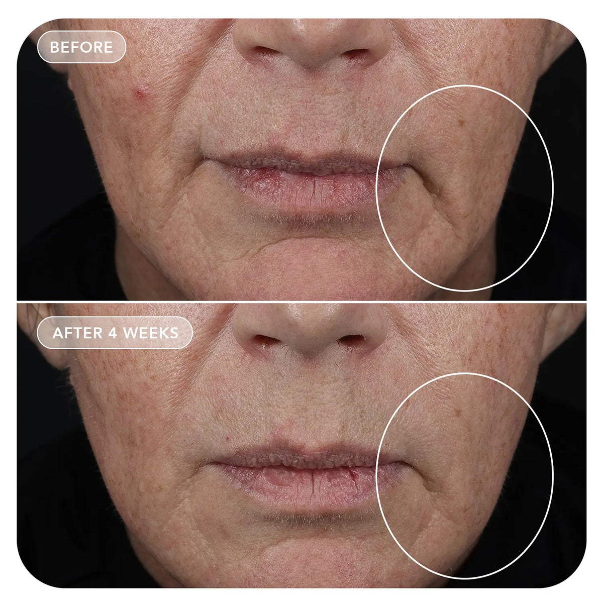 Image Skincare VOL.U.LIFT® GLP-1 4D Skin Rebound Complex