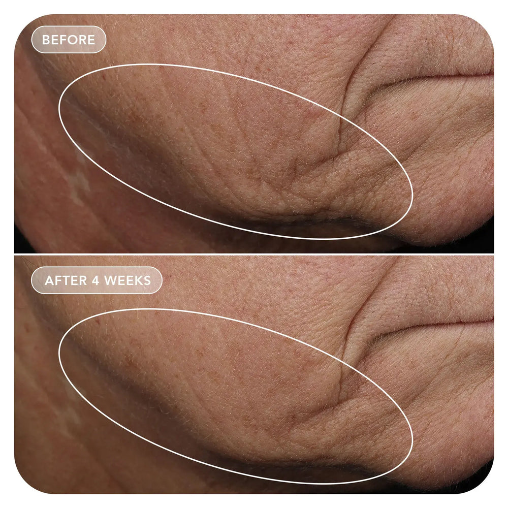 Image Skincare VOL.U.LIFT® GLP-1 4D Skin Rebound Complex