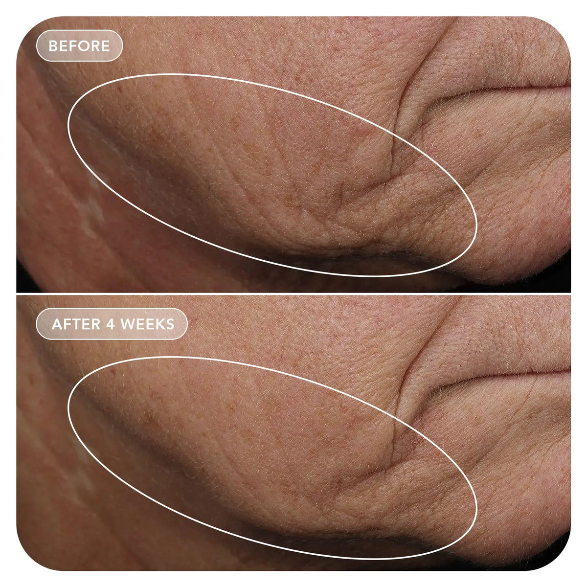 Image Skincare VOL.U.LIFT® GLP-1 4D Skin Rebound Complex