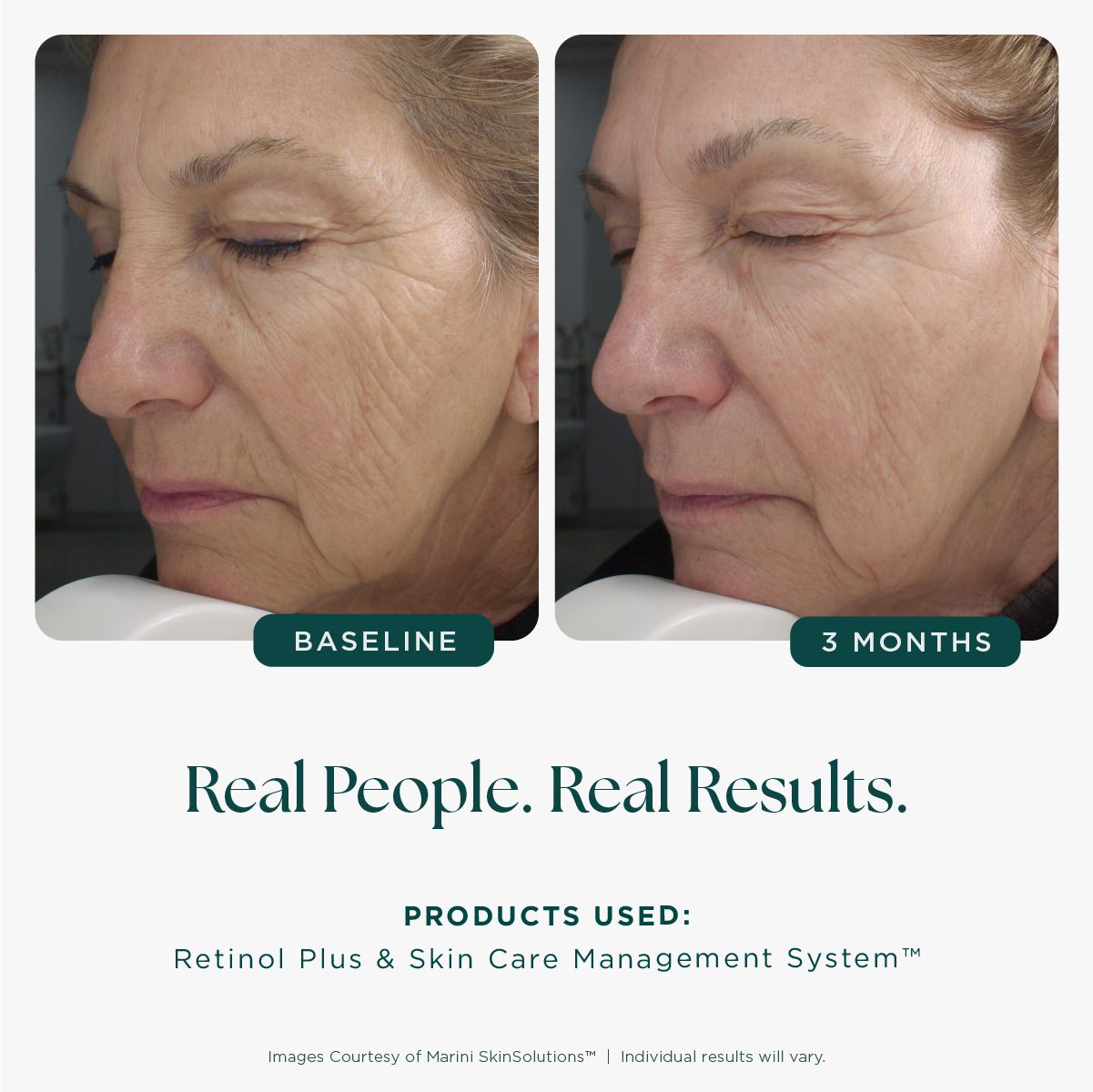 Marini Skin Solutions Retinol Plus – skinBEAUTIFUL RX