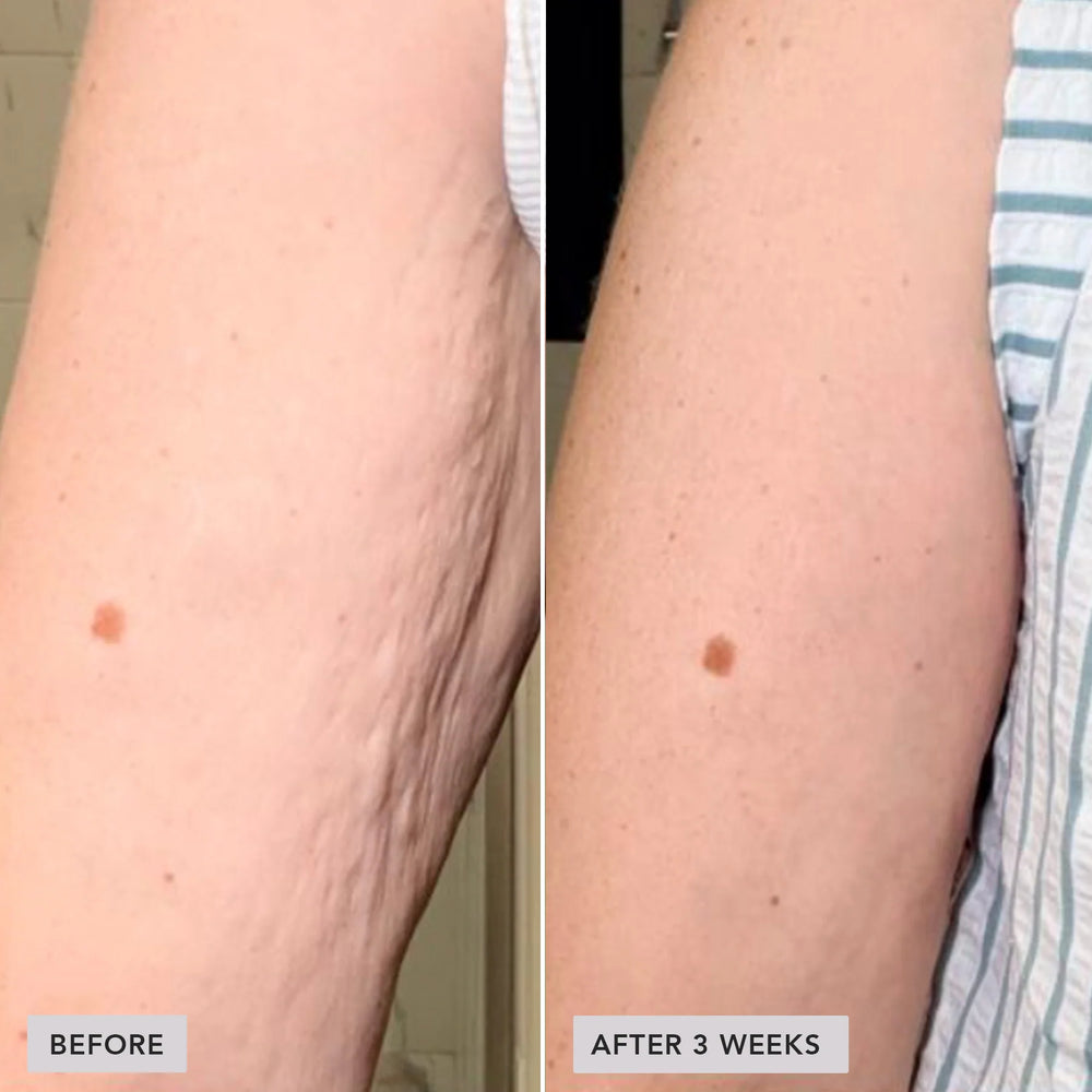 Image Skincare VOL.U.LIFT® BODY GLP-1/GIP Sculpt + Firm Treatment Complex