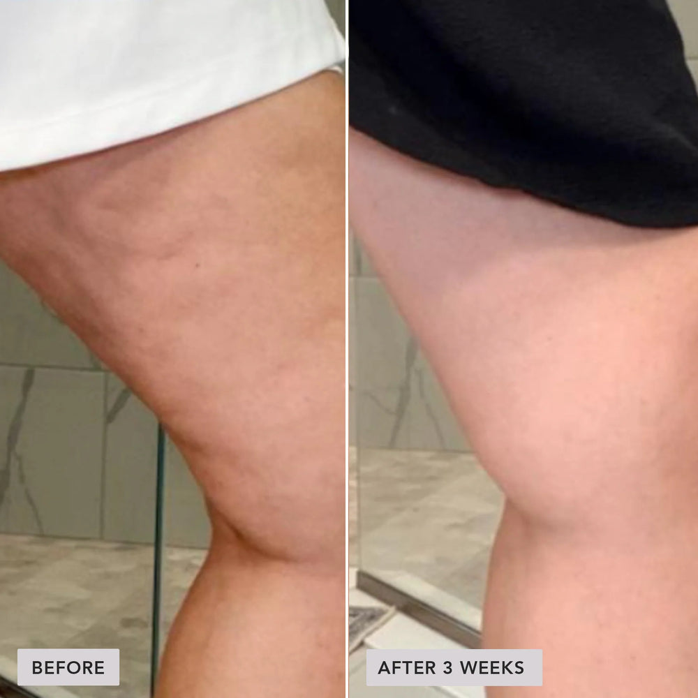 Image Skincare VOL.U.LIFT® BODY GLP-1/GIP Sculpt + Firm Treatment Complex