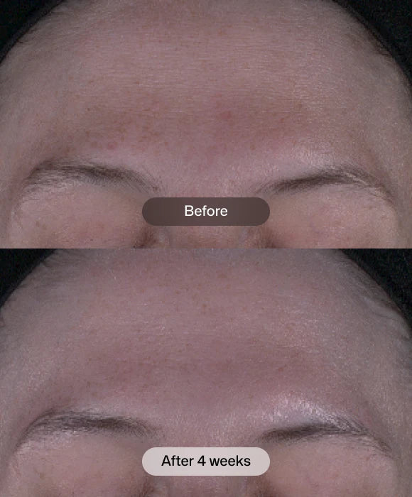 Revision Skincare Tone+ Correcting Pads™