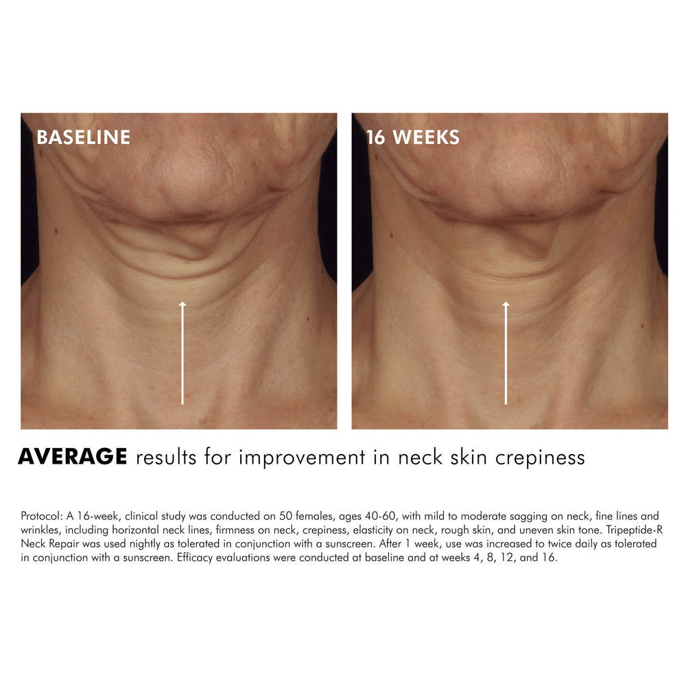 SkinCeuticals Tripeptide-R Neck Repair
