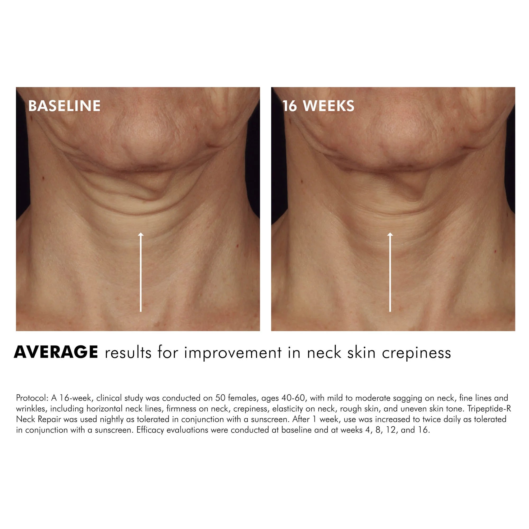 SkinCeuticals Tripeptide-R Neck Repair