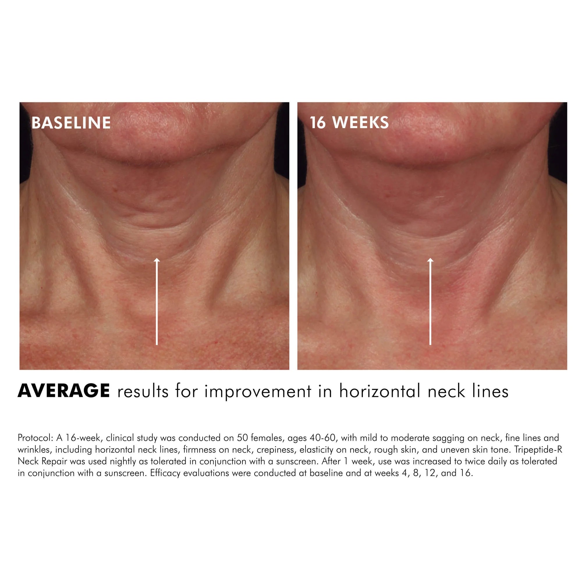 SkinCeuticals Tripeptide-R Neck Repair