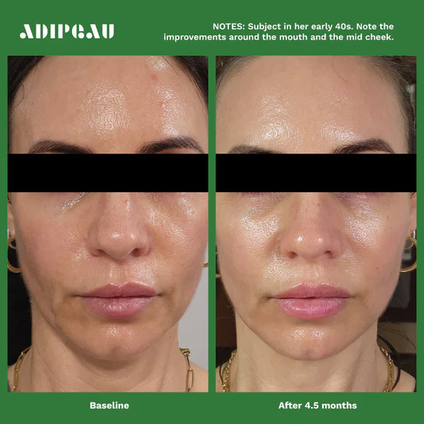 Adipeau Volume Cream
