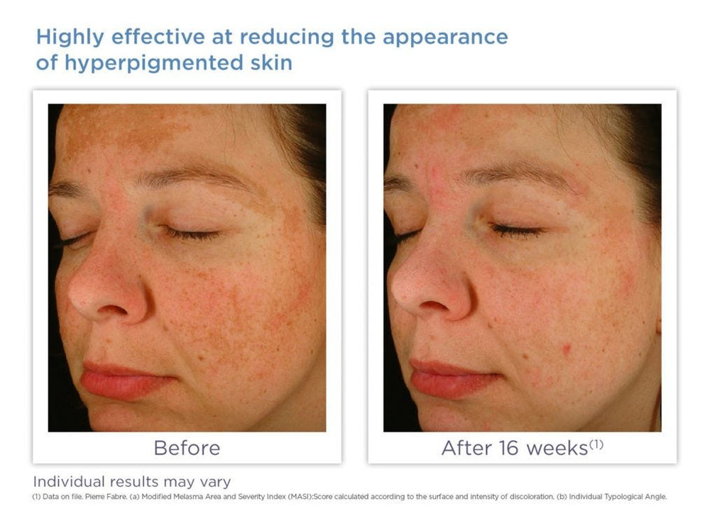 Glytone Enhance Brightening Complex