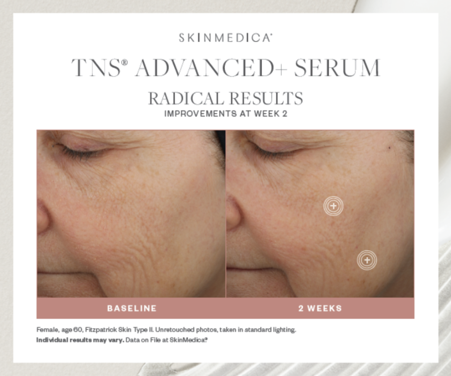 SkinMedica TNS Advanced+ Serum