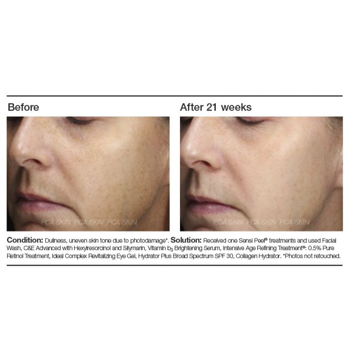 PCA Skin Vitamin B3 Brightening Serum